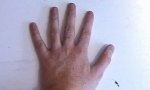 Onlinespiel : Crack my knuckles