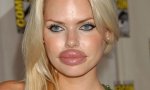 Miss Botox 2009