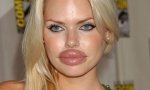 Fun Pic : Miss Botox 2009